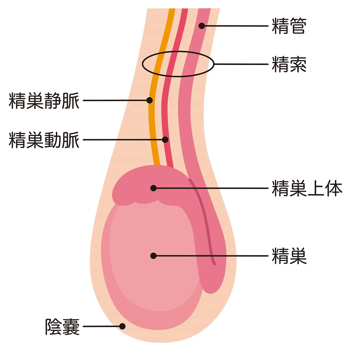 精巣捻転とは