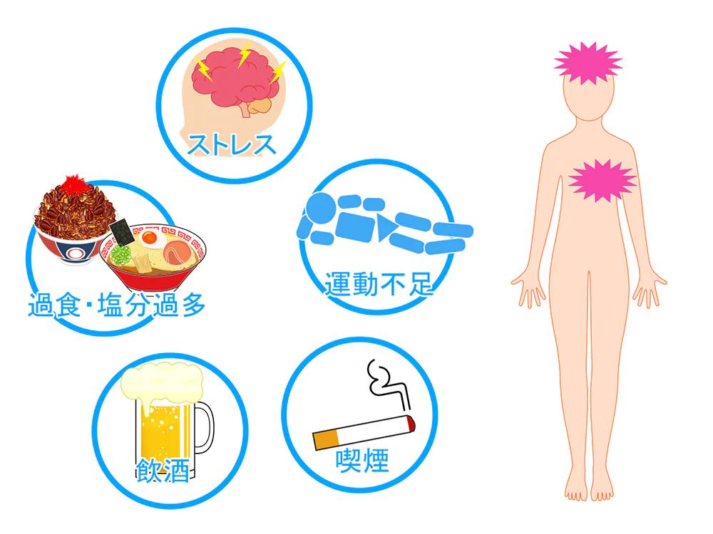 尿路結石の疫学や原因