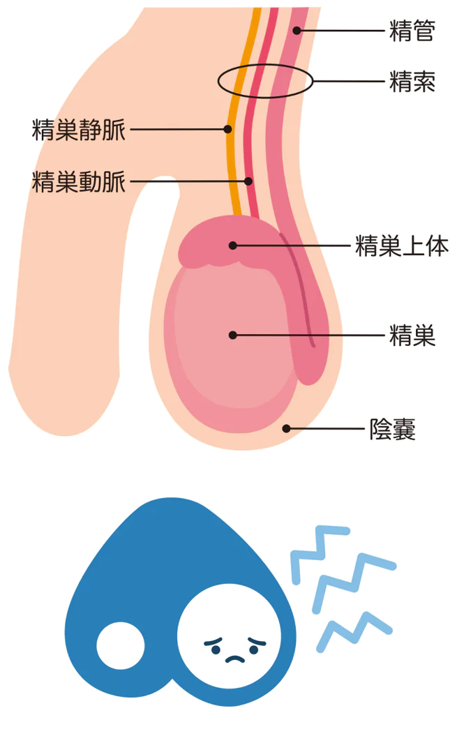 精巣上体炎の症状