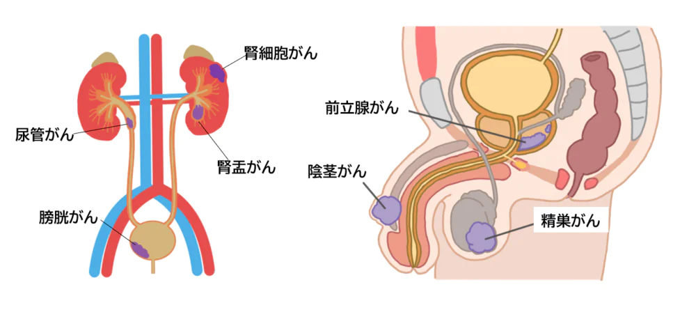 悪性疾患